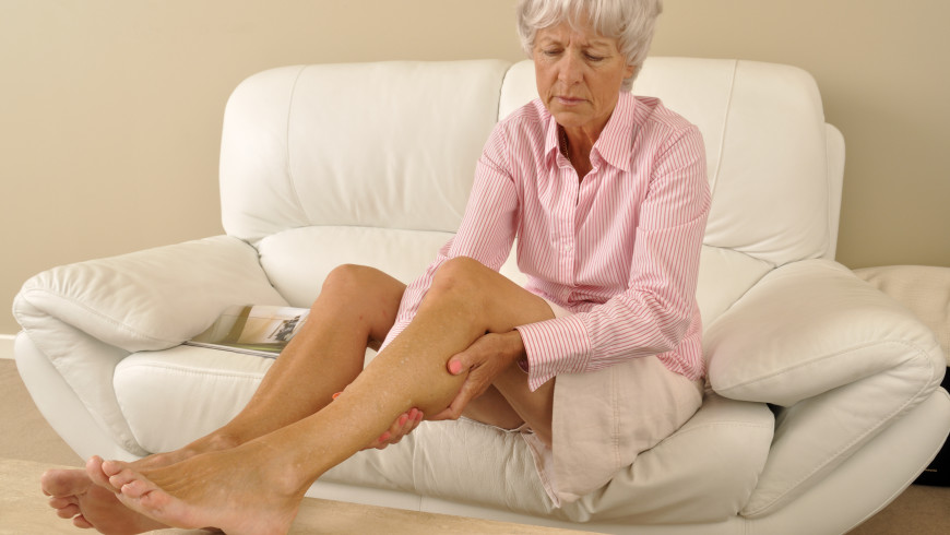 What serious health concerns do varicose veins pose?