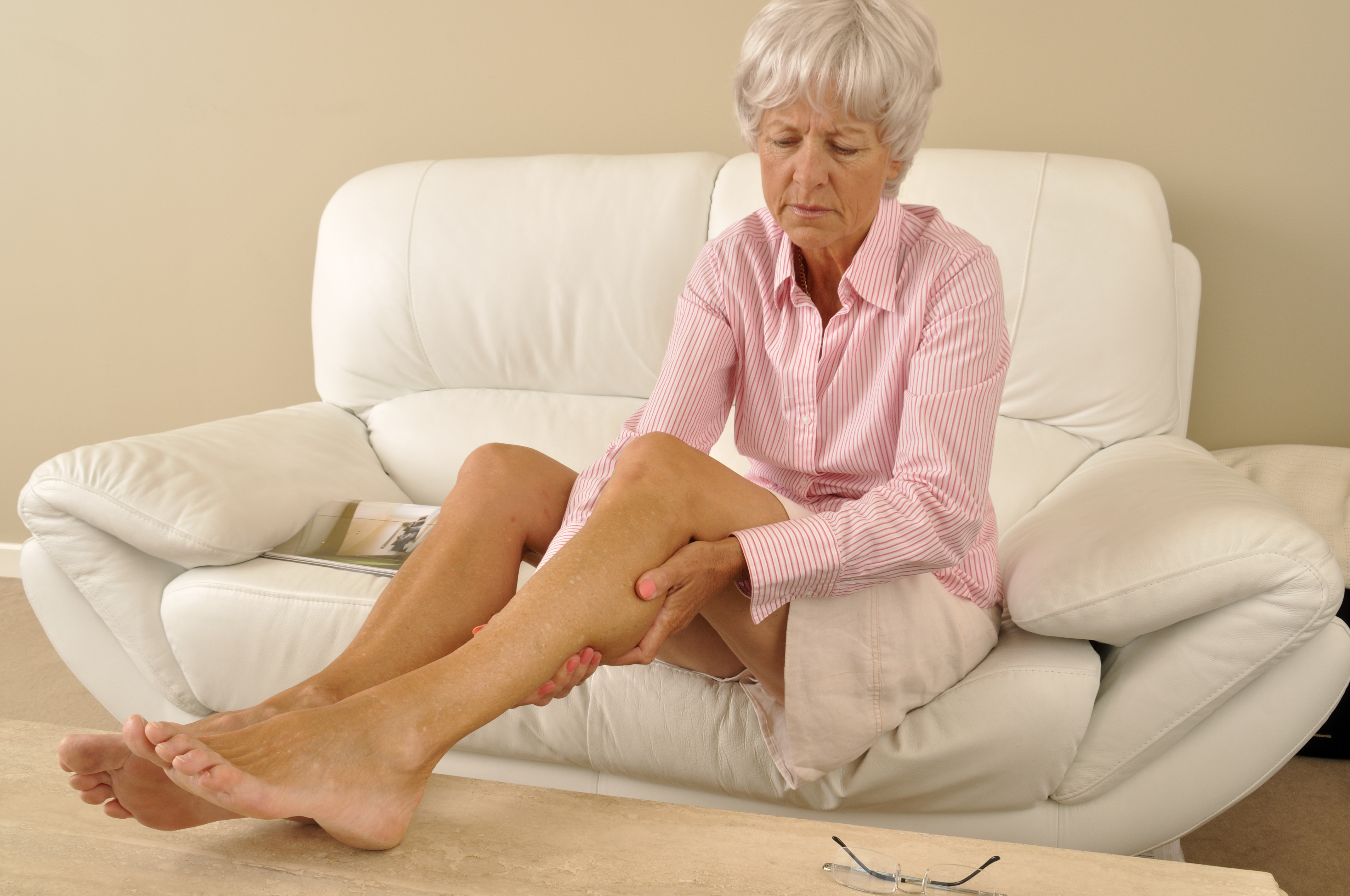 What serious health concerns do varicose veins pose?